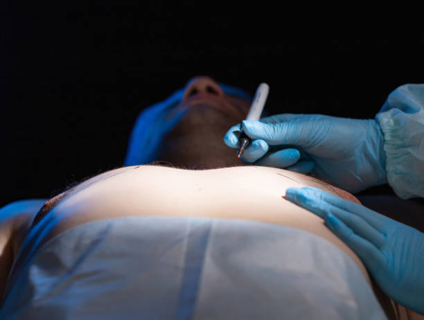 Best Gynecomastia Surgeon in Mulund Gynecomastia Surgeon