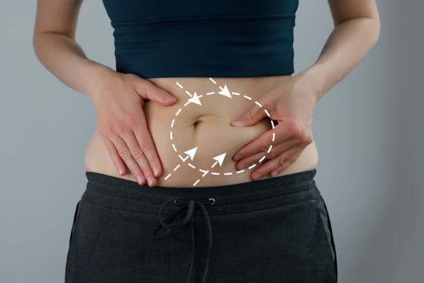 Best Tummy Tuck in Mulund Tummy Tuck
